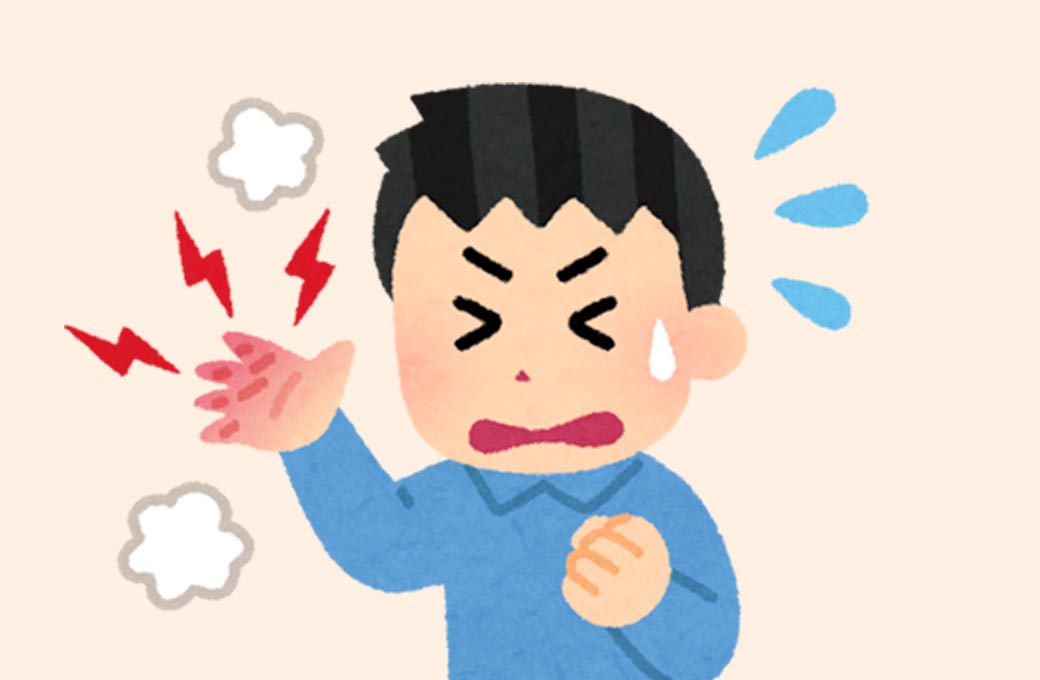 熱傷（やけど）イラスト